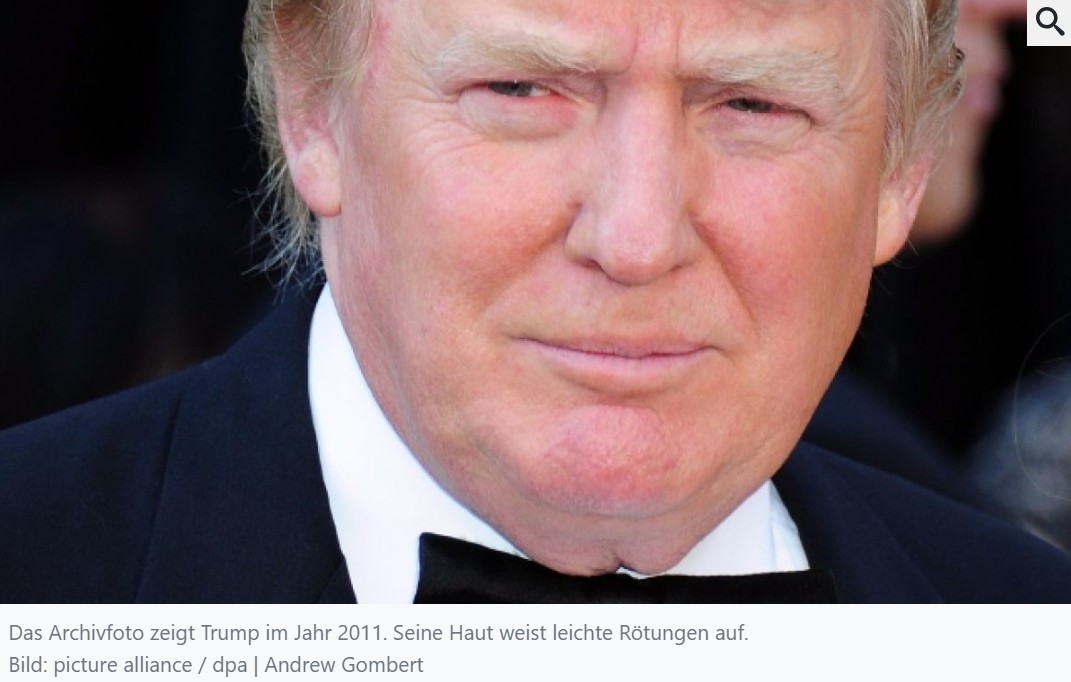 Die Zeitenwende, das Trump-Double enttarnt: Doppelgänger-Trump.